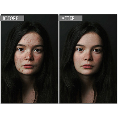 Skin Retouching